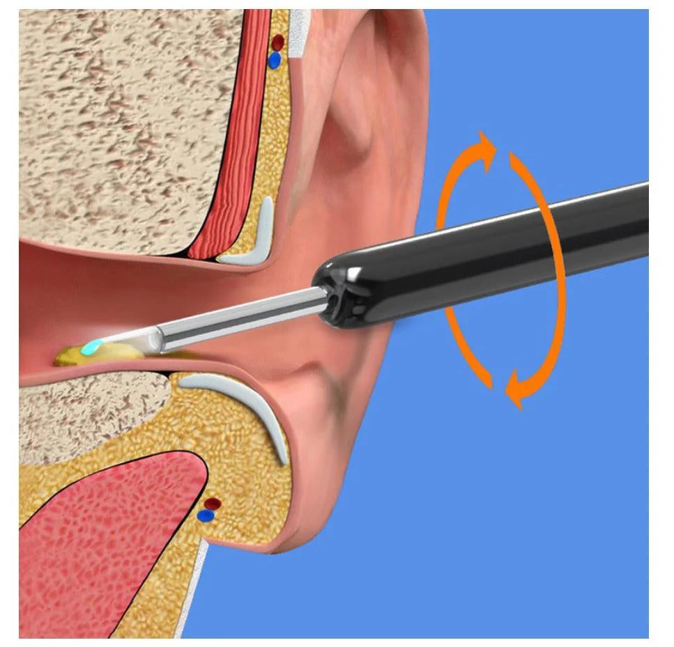 Earwax Removal Kit and health care